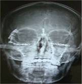 Picture10