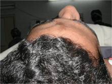 Picture17